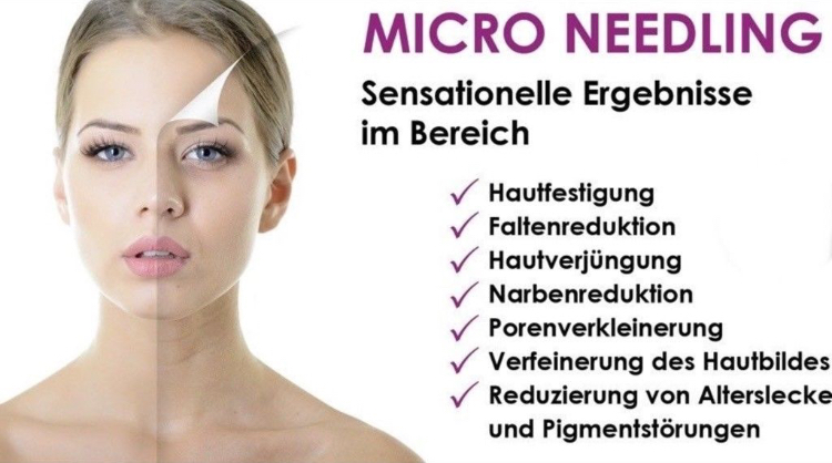 Micro Needling Beschreibung